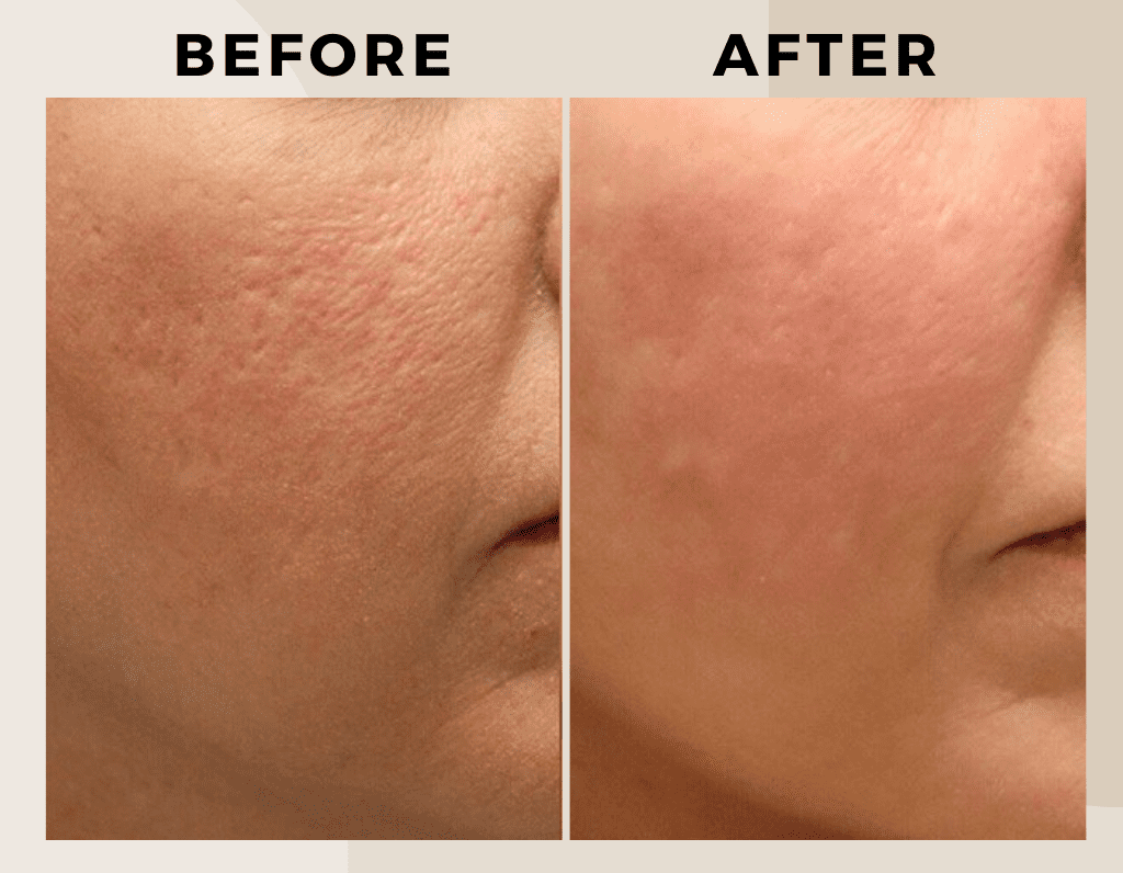 Copy of Brown Customer before and after Instagram Post (1024 x 796 px) (2)