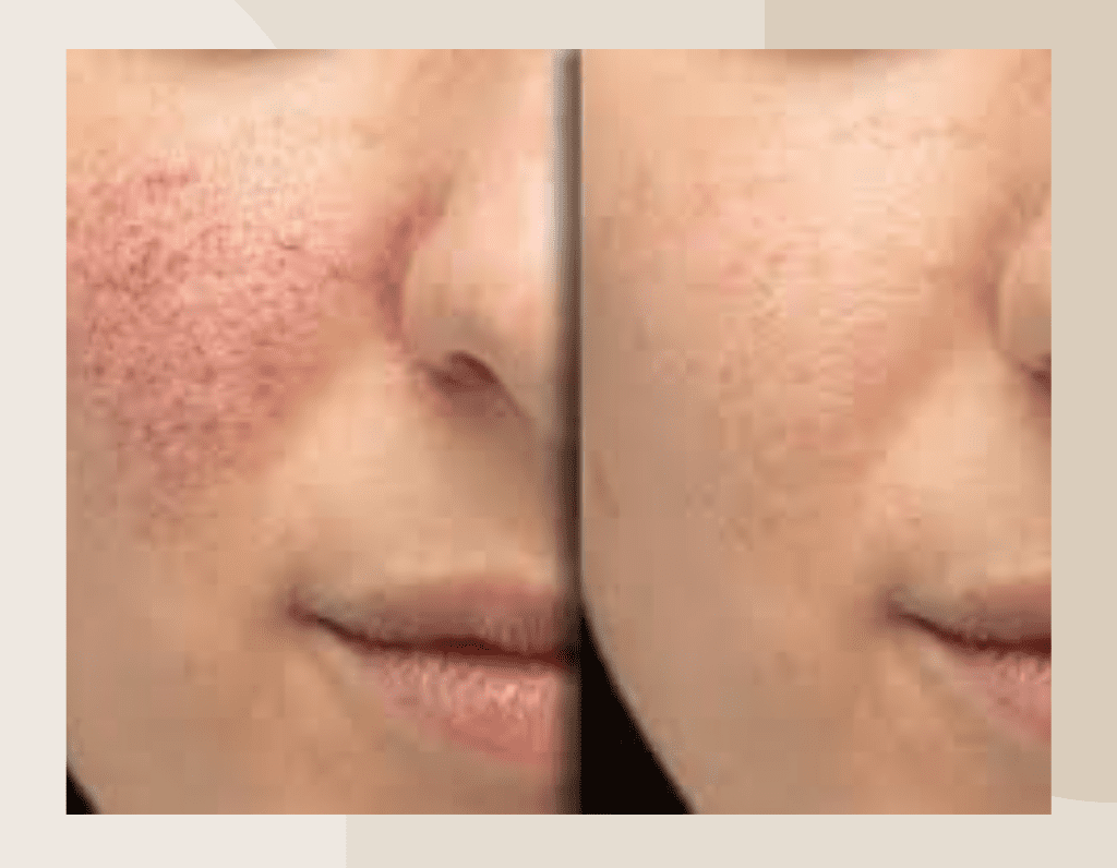 Copy of Brown Customer before and after Instagram Post (1024 x 796 px) (4)