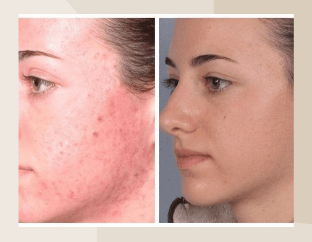 Copy of Brown Customer before and after Instagram Post (1024 x 796 px) (5)