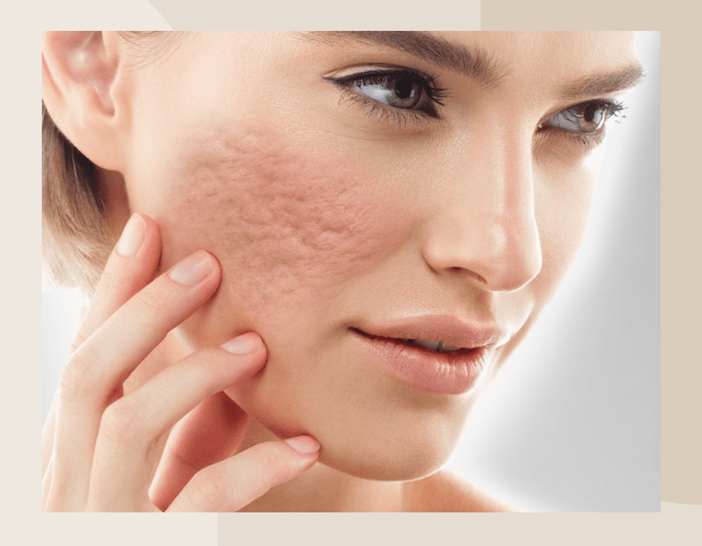 Copy of Brown Customer before and after Instagram Post (1024 x 796 px) (6)