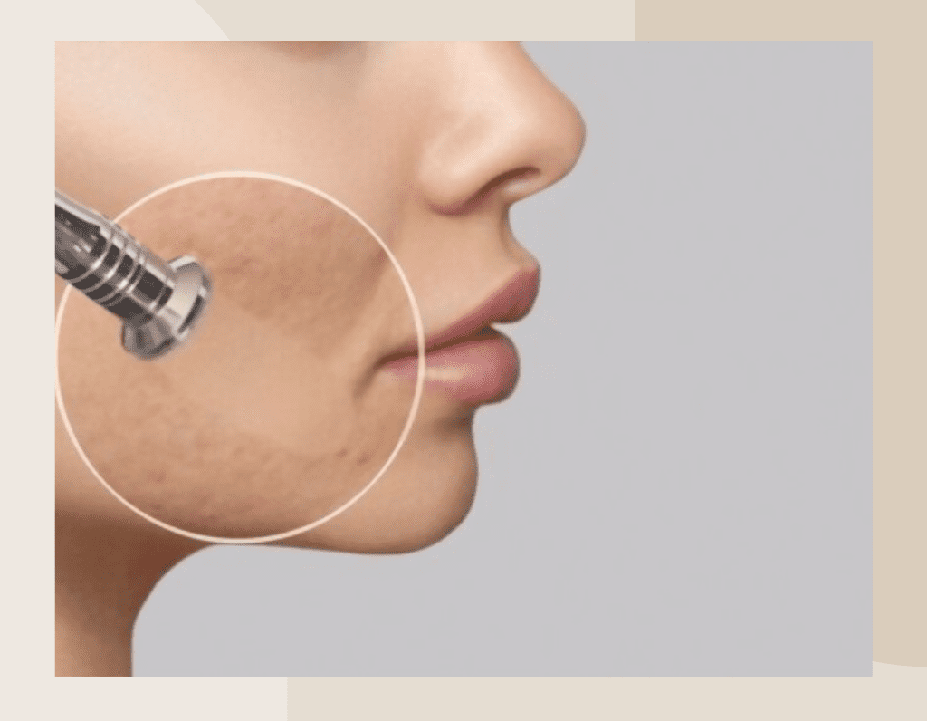 Copy of Brown Customer before and after Instagram Post (1024 x 796 px) (7)