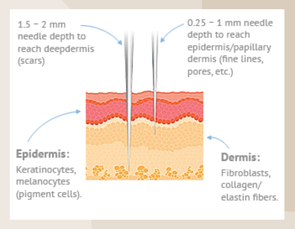 Microneedling The Facts About this Buzzworthy-Skin Procedure-ritus-skin-care