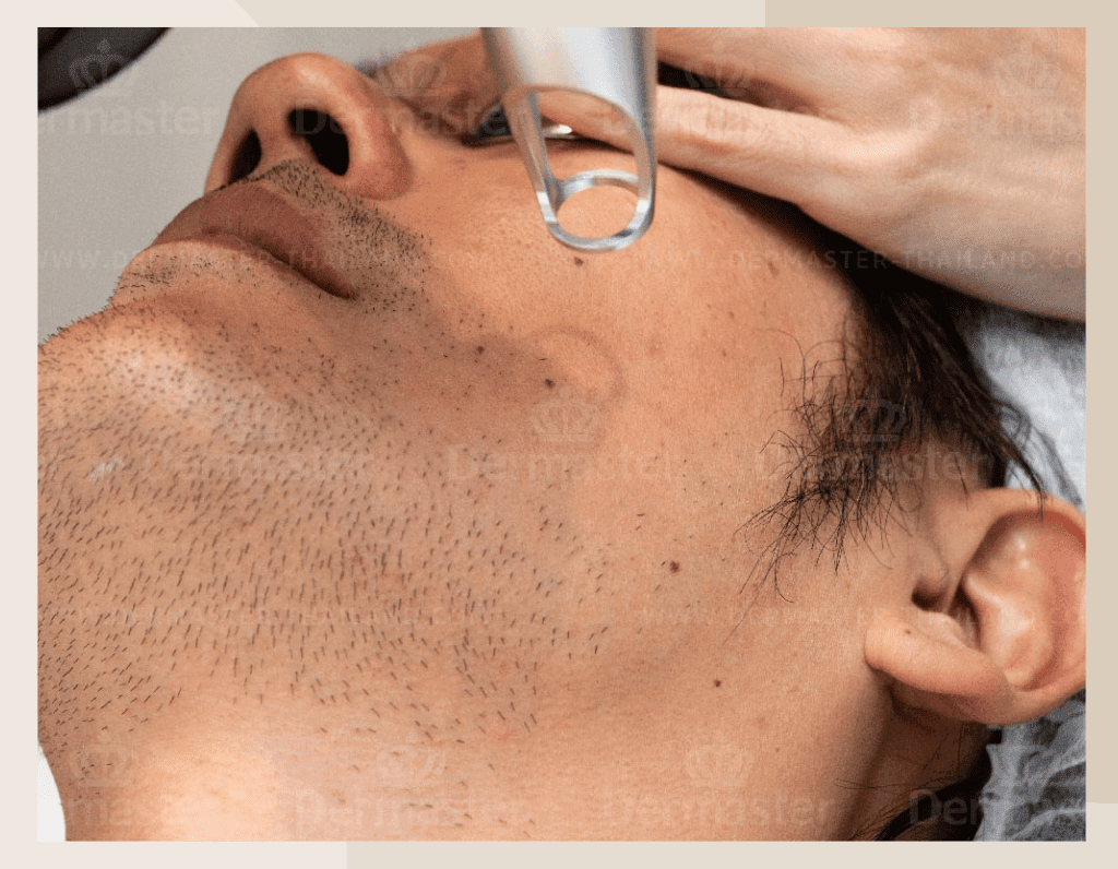 best-skin-care-clinic-in-hyderabad-3