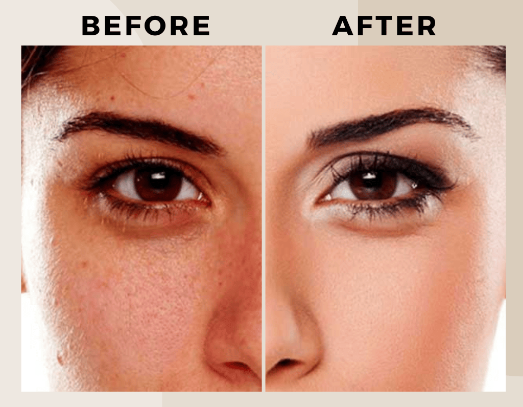best-skin-care-clinic-in-hyderabad-5
